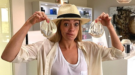 Kobiety, skalpel i liposukcja (2)