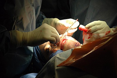 Usunąć wspomnienia (2)